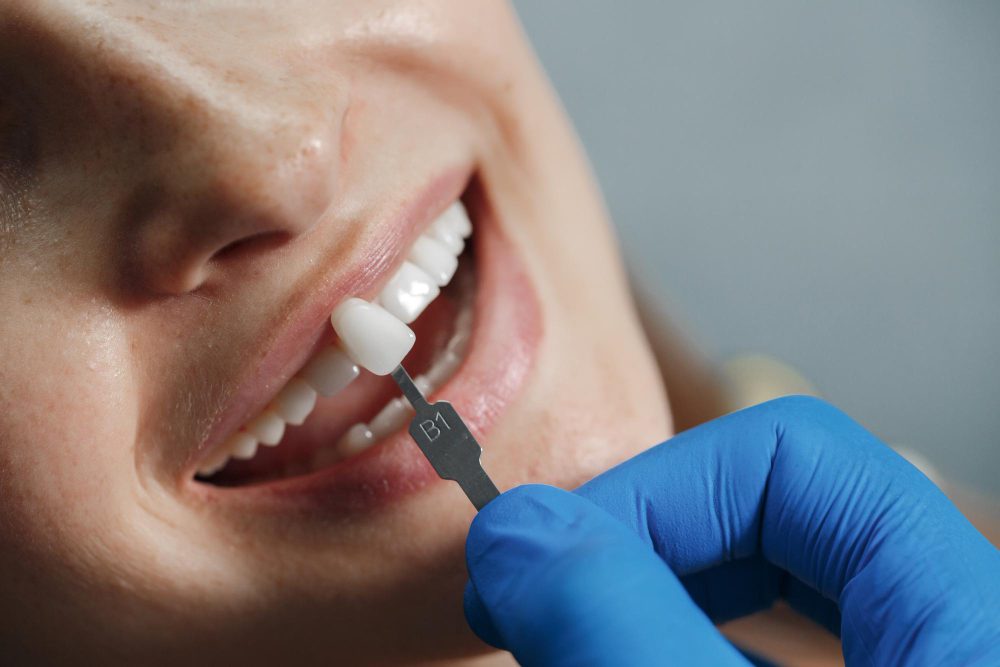 Discover Your Next Smile with Dental Implants