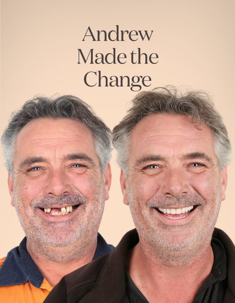 Andrew before and after treatment
