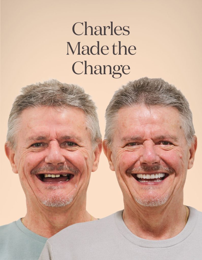 Charles before and after treatment