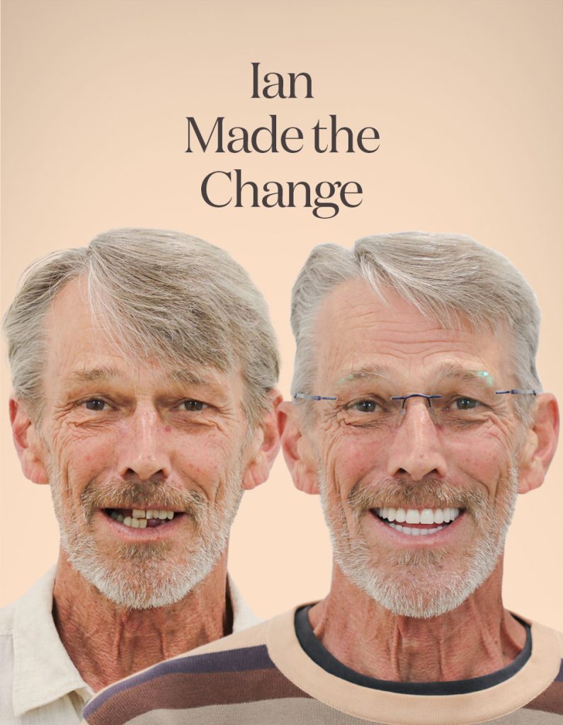 Ian before and after treatment
