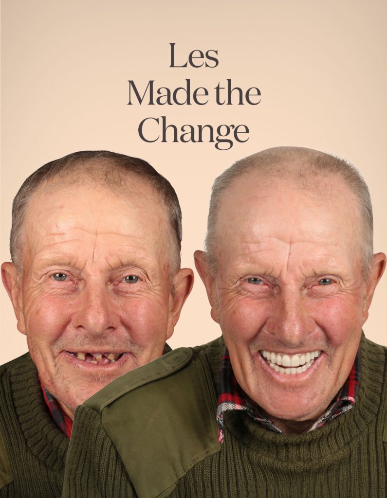 Les before and after treatment