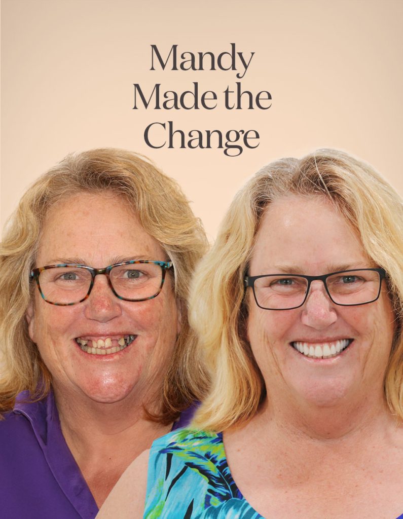 Mandy before and after treatment