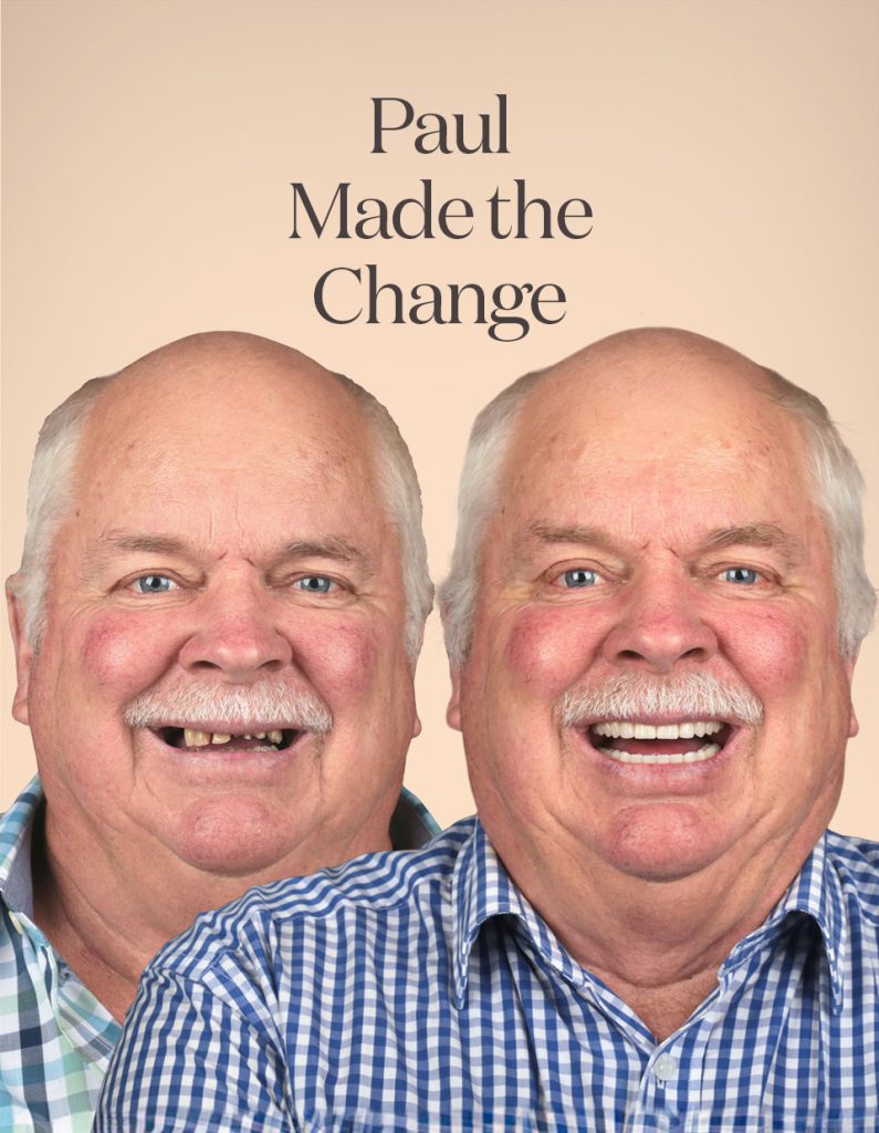 Paul before and after treatment