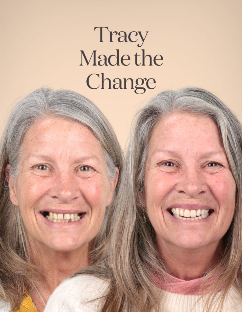 Tracy before and after treatment